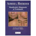 Acneea si rozaceea. Manifestari, diagnostic si tratament