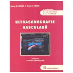 Ultrasonografie vasculară