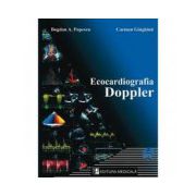 Ecocardiografia Doppler