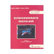 Ultrasonografie vasculară